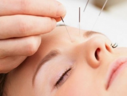 facial acupuncture